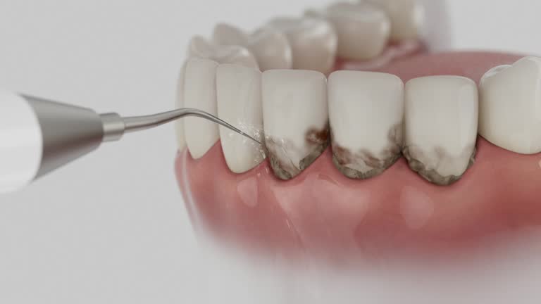 Reliable Dental Implants contractor in Taft, TX by Smile Center Dentistry